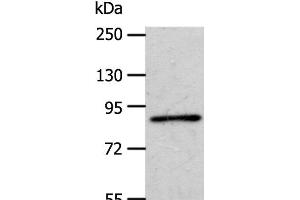 Western Blot analysis of A172 cell using APPL1 Polyclonal Antibody at dilution of 1:600 (APPL1 antibody)