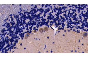 Detection of TNFa in Rat Cerebellum Tissue using Polyclonal Antibody to Tumor Necrosis Factor Alpha (TNFa) (TNF alpha antibody  (AA 80-235))