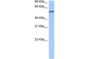 Western Blotting (WB) image for anti-RNA Pseudouridylate Synthase Domain Containing 2 (RPUSD2) antibody (ABIN2462339) (RPUSD2 antibody)