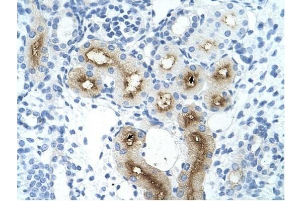 GGTLC1 antibody  (C-Term)