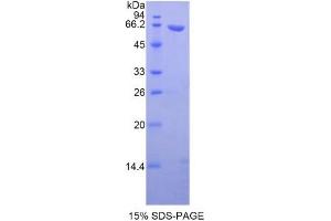 SDS-PAGE of Protein Standard from the Kit (Highly purified E. (WNT5A ELISA Kit)