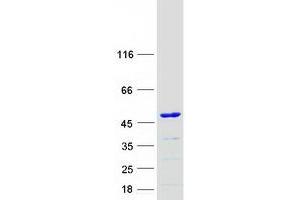 Validation with Western Blot (KTI12 Protein (Myc-DYKDDDDK Tag))