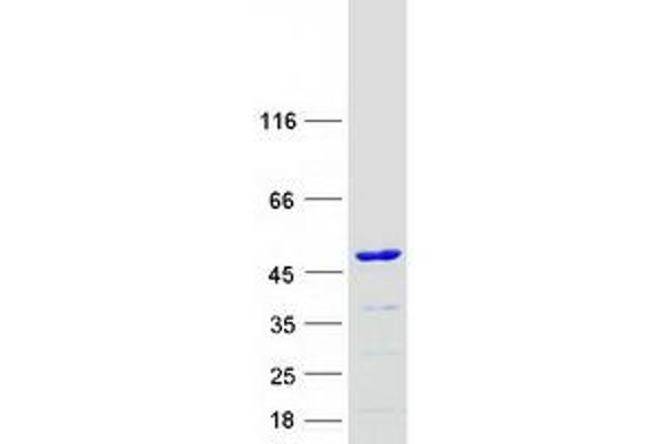 KTI12 Protein (Myc-DYKDDDDK Tag)