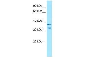 WB Suggested Anti-MRGPRX1 Antibody Titration: 1. (MRGPRX1 antibody  (C-Term))