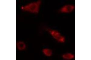 ABIN6274161 staining HepG2 cells by IF/ICC. (POLA1 antibody  (N-Term))