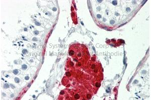 Rabbit Anti-BAP / SIL1 antibody   Formalin Fixed Paraffin Embedded Tissue: Human Adult Testis  Observed Staining: Cytoplasm in hepatocytes Primary Antibody Concentration: 1:600 Secondary Antibody: Donkey anti-Rabbit-Cy3 Secondary Antibody Concentration: 1:200 Magnification: 20X Exposure Time: 0. (SIL1 antibody  (C-Term))