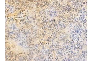 anti-Retinoblastoma Protein (Rb Protein) (pSer795) antibody