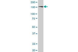 ROCK2 antibody  (AA 1279-1388)