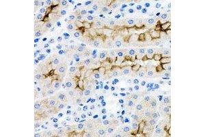 Immunohistochemical analysis of IRSp53 staining in rat kidney formalin fixed paraffin embedded tissue section.