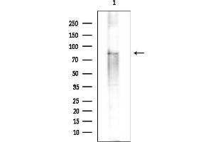 Western blot analysis of lysates from EC304 cells(heat-shock treatment), using PIK3R6 Antibody at 1/1000 dilution.
