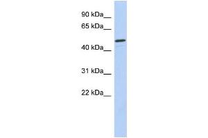 Western Blotting (WB) image for anti-Checkpoint Kinase 1 (CHEK1) (Middle Region) antibody (ABIN2779737)
