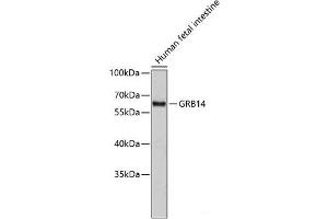 Western blot analysis of extracts of Human fetal intestine using GRB14 Polyclonal Antibody. (GRB14 antibody)