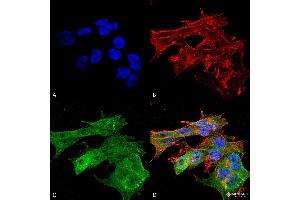 Immunocytochemistry/Immunofluorescence analysis using Mouse Anti-Versican Monoclonal Antibody, Clone S351-23 . (Versican antibody  (AA 362-585) (Biotin))