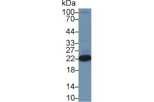 Detection of PARK7 in Rat Heart lysate using Polyclonal Antibody to Parkinson Disease Protein 7 (PARK7)
