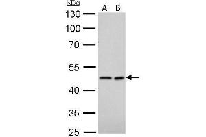 WB Image NDRG1 antibody detects NDRG1 protein by Western blot analysis. (NDRG1 antibody)