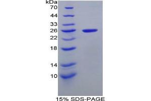 SDS-PAGE analysis of Rat Intercellular Adhesion Molecule 4 Protein. (ICAM4 Protein)