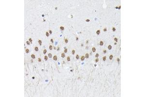 Immunohistochemistry of paraffin-embedded mouse brain using PTBP2 Rabbit pAb (ABIN6128372, ABIN6146373, ABIN6146374 and ABIN6221684) at dilution of 1:100 (40x lens).