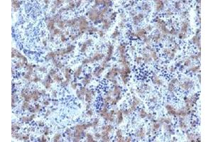 Immunohistochemical staining (Formalin-fixed paraffin-embedded sections) of human fetal liver with GPC3 recombinant monoclonal antibody, clone GPC3/1534R . (Recombinant Glypican 3 antibody)