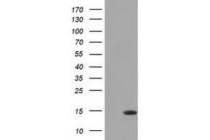 HEK293T cells were transfected with the pCMV6-ENTRY control (Left lane) or pCMV6-ENTRY CISD1 (Right lane) cDNA for 48 hrs and lysed. (CISD1 antibody)