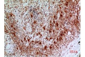 Immunohistochemistry (IHC) analysis of paraffin-embedded Human Brain, antibody was diluted at 1:100. (CD200 antibody  (Internal Region))