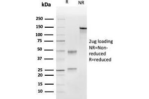 SDS-PAGE Analysis Purified UBE2C Mouse Monoclonal Antibody (CPTC-UBE2C-1). (UBE2C antibody)