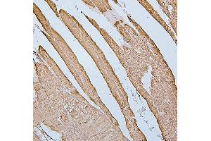 IHC analysis of Desmin using anti-Desmin antibody (ABIN7599249).