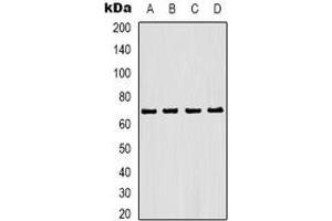 Western blot analysis of Estrogen Receptor alpha expression in Hela (A), MCF7 (B), mouse liver (C), rat liver (D) whole cell lysates. (Estrogen Receptor alpha antibody)