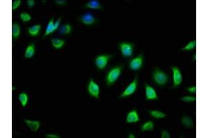 Immunofluorescence staining of A549 cells with ABIN7154600 at 1:166, counter-stained with DAPI. (RIT2 antibody  (AA 1-150))