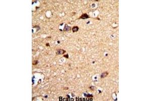Immunohistochemistry (IHC) image for anti-Unc-5 Homolog C (C. Elegans) (Unc5c) antibody (ABIN3002880) (Unc5c antibody)