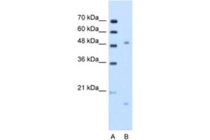 Western Blotting (WB) image for anti-Integrin, beta-Like 1 (With EGF-Like Repeat Domains) (ITGBL1) antibody (ABIN2462542) (ITGBL1 antibody)