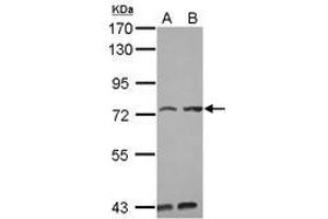 Image no. 2 for anti-Pumilio RNA Binding Family Member 3 (PUM3) (AA 415-648) antibody (ABIN1499029) (KIAA0020 antibody  (AA 415-648))