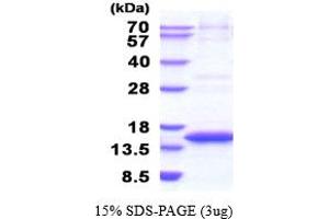 SDS-PAGE (SDS) image for Cystatin E/M (CST6) (AA 29-149) (Active) protein (His tag) (ABIN6387720) (CST6 Protein (AA 29-149) (His tag))