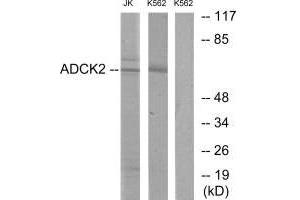 Western blot analysis of extracts from Jurkat cells and K562 cells, using ADCK2 antibody. (ADCK2 antibody)