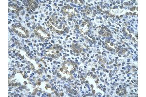 Rabbit Anti-WWP2 Antibody       Paraffin Embedded Tissue:  Human alveolar cell   Cellular Data:  Epithelial cells of renal tubule  Antibody Concentration:   4. (WWP2 antibody  (Middle Region))