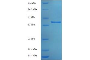 SDS-PAGE (SDS) image for Interferon alpha/beta Receptor 2 (IFNAR2) (AA 27-243) protein (His-SUMO Tag) (ABIN5709721) (IFNAR2 Protein (AA 27-243) (His-SUMO Tag))