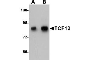 Western Blotting (WB) image for anti-Transcription Factor 12 (TCF12) (N-Term) antibody (ABIN1031604) (TCF12 antibody  (N-Term))