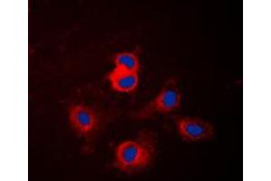 Immunofluorescent analysis of Cytochrome P450 17A1 staining in NIH3T3 cells. (CYP17A1 antibody  (Center))