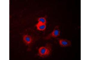 Immunofluorescent analysis of Cytochrome P450 17A1 staining in NIH3T3 cells. (CYP17A1 antibody  (Center))