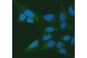 IF analysis of SETD3 using anti-SETD3 antibody (ABIN7600293). (SETD3 antibody  (AA 173-468))