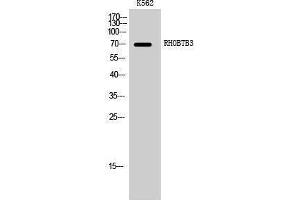 Western Blotting (WB) image for anti-rho-Related BTB Domain Containing 3 (RHOBTB3) (Internal Region) antibody (ABIN3186757) (RHOBTB3 antibody  (Internal Region))