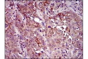Immunohistochemical analysis of paraffin-embedded endometrium tissues using CD33 mouse mAb with DAB staining.