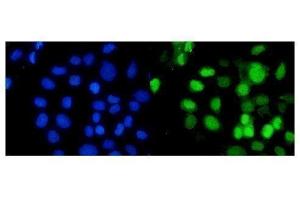 IF analysis of RbAp48 using anti-RbAp48 antibody (ABIN3043920). (Retinoblastoma Binding Protein 4 antibody  (C-Term))