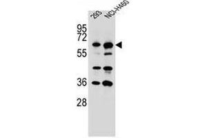 CKAP4 Antibody (C-term) western blot analysis in 293,NCI-H460 cell line lysates (35µg/lane). (CKAP4 antibody  (C-Term))