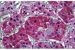 Human Adrenal: Formalin-Fixed, Paraffin-Embedded (FFPE) (CAMKK1 antibody  (AA 1-521))