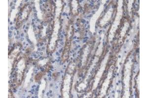 IHC-P analysis of Mouse Kidney Tissue, with DAB staining. (RIPK2 antibody  (AA 1-294))