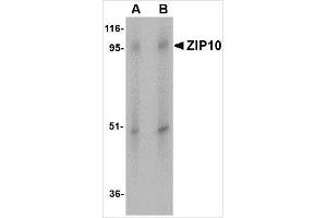 Western blot analysis of ZIP10 in human spleen tissue lysate with ZIP10 antibody at (A) 1 and (B) 2 μg/ml. (SLC39A10 antibody  (Center))