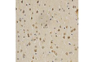 Immunohistochemistry of paraffin-embedded mouse brain using HDAC6 antibody (ABIN5997884) at dilution of 1/100 (40x lens). (HDAC6 antibody)