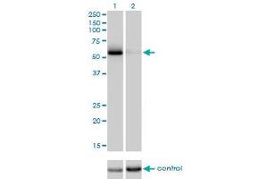 Western blot analysis of CDC25C over-expressed 293 cell line, cotransfected with CDC25C Validated Chimera RNAi (Lane 2) or non-transfected control (Lane 1). (CDC25C antibody  (AA 21-130))