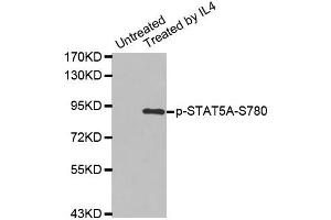 Western blot analysis of extracts from K562 cells using Phospho-STAT5A-S780 antibody (ABIN2987413). (STAT5A antibody  (pSer780))