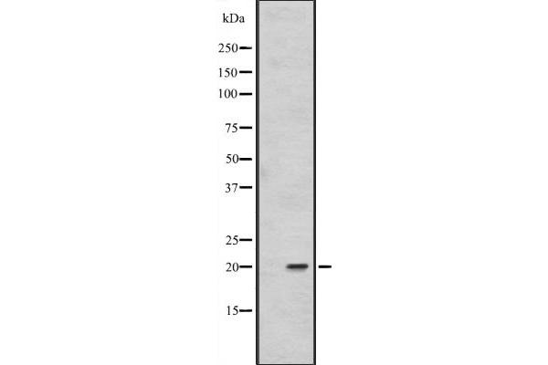 FAIM antibody  (Internal Region)